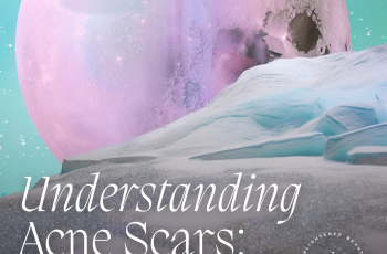 UNDERSTANDING ACNE SCARS: TYPES AND TREATMENTS
