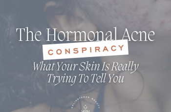 WHAT CAUSES HORMONAL ACNE: YOUR QUESTIONS ANSWERED