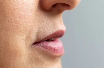 How Do I Get Rid of Deep Wrinkles Around My Mouth?