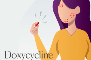 USING DOXYCYCLINE TO TREAT ACNE? AN ESTHETICIAN’S PERSPECTIVE