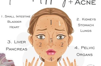 How to cure dry skin on face overnight?