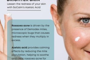 What Does Azelaic Acid Do for Rosacea