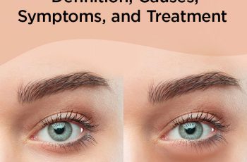 What are the causes of puffy eyes and how to get rid of it