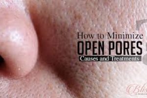 How Can You Reduce Enlarged Pores