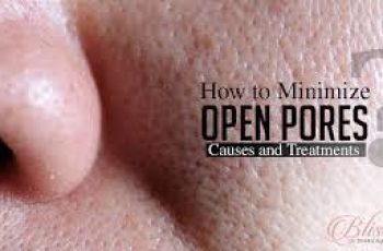 How Can You Reduce Enlarged Pores