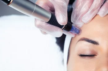 Can I Use Lactic Acid After Microneedling?