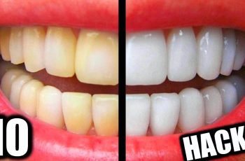 10 Beauty Hacks To Whiten Your Teeth