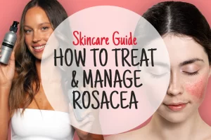 What Skincare Ingredients To Avoid If You Have Rosacea