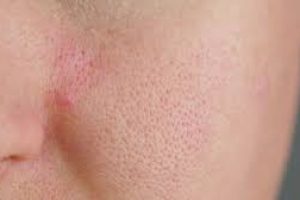 How to deep clean your pores?