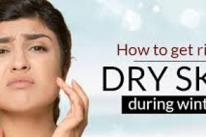 How do you get rid of dry skin in the winter?