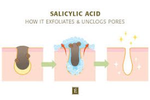 How does salicylic acid work?