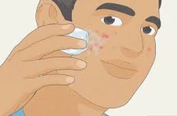 How to get rid of pimples?