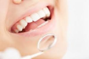 Frequently Asked Questions (FAQ) about Teeth Whitening Strips