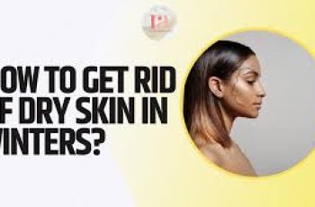 How do you get rid of dry skin in the winter?