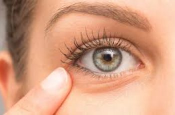 How to Treat and Prevent Under-Eye Wrinkles