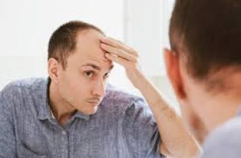 Male Pattern Baldness Explained – Symptoms and Causes