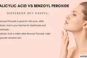 Should I use benzoyl peroxide or salicylic acid first?