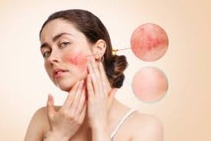 Symptoms, Causes, and Care for Sensitive Skin