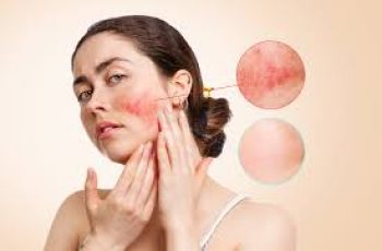 Symptoms, Causes, and Care for Sensitive Skin