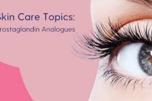 Prostaglandin Analogues for Lashes: Are They Safe?