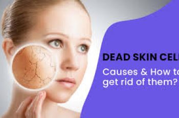 Dead Skin Cells: Causes and How to Remove Them