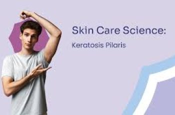 The Science of Keratosis Pilaris (Chicken Skin)