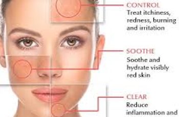 Dermatologist Advice on How To Treat Rosacea