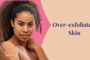 Over Exfoliated Skin: What To Do When You Scrub Too Much