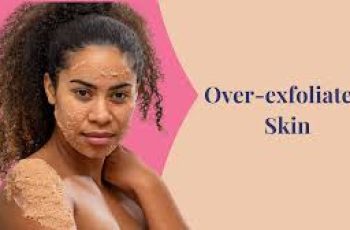 Over Exfoliated Skin: What To Do When You Scrub Too Much