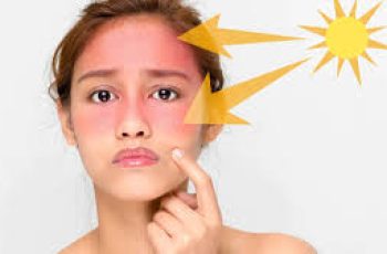 Retinol Sun Sensitivity and Photosensitivity