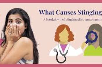 Stinging Skin: Sensitive Skin That Burns