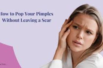 How to Pop a Pimple Correctly Without Leaving a Scar