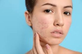 When To See A Dermatologist For Acne