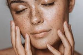 Tranexamic acid for skin treatments