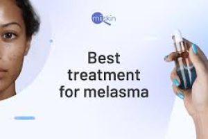 Best Treatment For Melasma on the Face