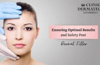 Essential Aftercare Tips for Optimal Results Post-Dermal Fillers