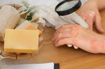Best Soap for Psoriasis: A Guide to the Right Cleansers for Your Skin