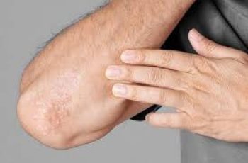 Understanding Rough, Bumpy Skin: Causes and Effective Treatments Understanding Rough, Bumpy Skin: Causes and Effective Treatments