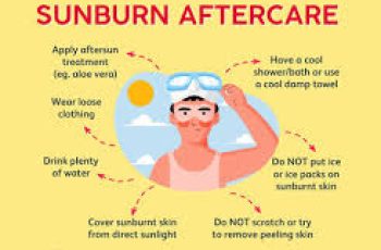 “Effective Skincare Tips for Sunburn: What to Avoid and Use”