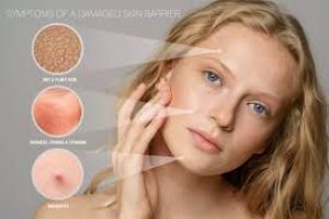 Skin Barrier and Causes of A Damaged Skin Barrier