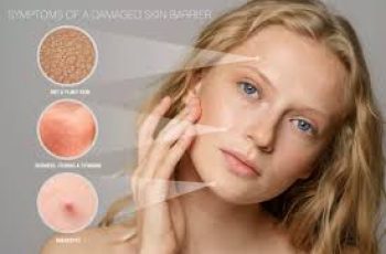 Skin Barrier and Causes of A Damaged Skin Barrier