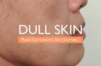 Dull Skin