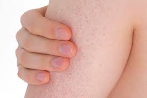 Scaly Skin Patches? How to Restore Smooth, Healthy Skin