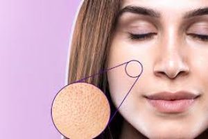 Effective Ways to Minimize Enlarged Pores for Smoother Skin