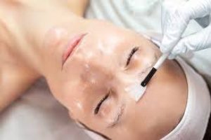 How Chemical Exfoliation Enhances Skin Health and Radiance