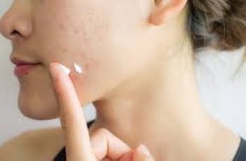 How Long Can You Safely Use Azelaic Acid in Skincare? How Long Can You Safely Use Azelaic Acid in Skincare?