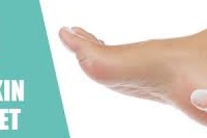 Soft Feet Naturally: Easy DIY Remedies for Hard Skin and Calluses