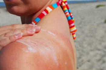 Sun Exposure Recovery: Must-Have Treatments to Revive Your Skin Sun Exposure Recovery: Must-Have Treatments to Revive Your Skin