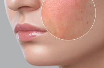 How to Tell If Your Skin Is Dry or Dehydrated