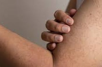 Tired of Bumpy Skin? Here’s How Salicylic Acid Can Help with Keratosis Pilaris Tired of Bumpy Skin? Here’s How Salicylic Acid Can Help with Keratosis Pilaris